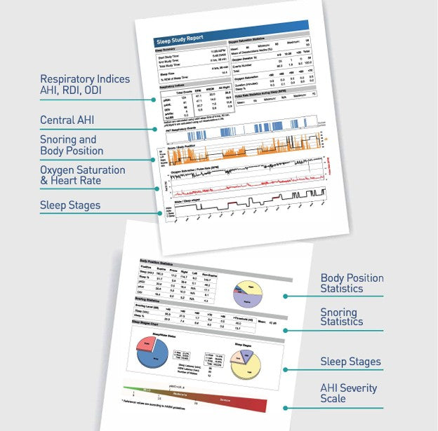 Two printed sleep study report sheets on a light gray background, each with callout lines pointing to labeled chart sections such as respiratory indices, central AHI, snoring and body position, oxygen saturation and heart rate, sleep stages, body position statistics, and AHI severity scale.